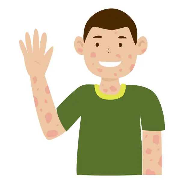 Vector illustration of man with leprosy disease smile and arms raised