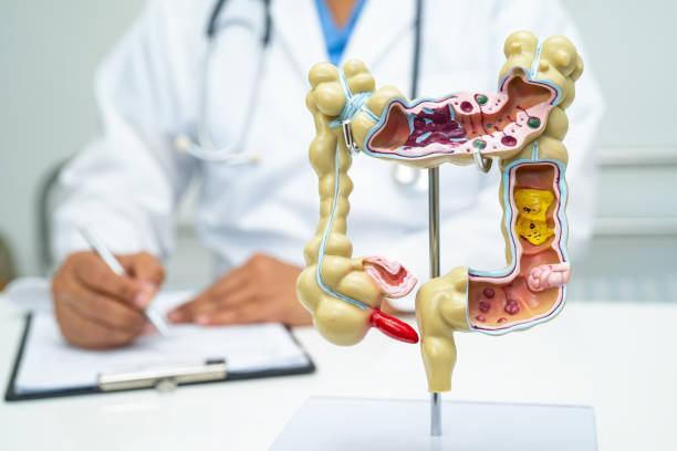 istock Intestine, appendix and digestive system, doctor holding anatomy model for study diagnosis and treatment in hospital. 1924752682