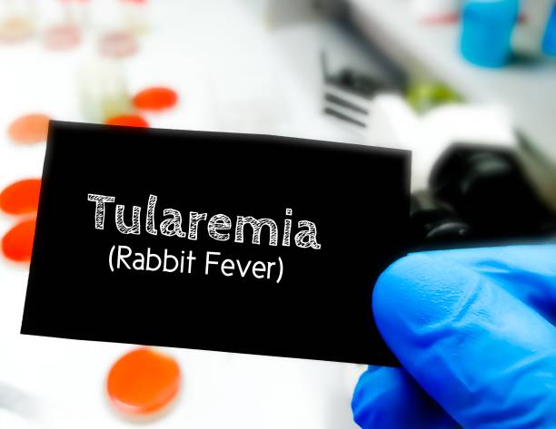 Tularemia medical term on a card in doctor hand. Medical conceptual image. Rabbit fever. Francisella tularensis Tularemia medical term on a card in doctor hand. Medical conceptual image. Rabbit fever. Francisella tularensis tularemia stock pictures, royalty-free photos & images
