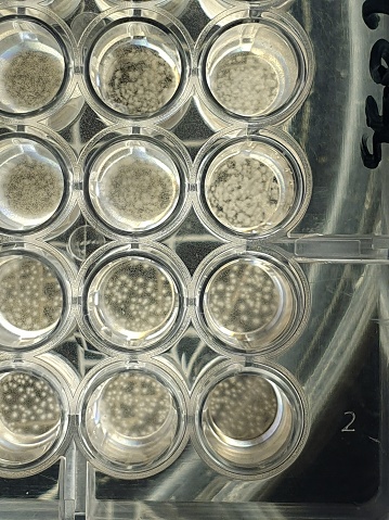 Scientific picture of microdilution test for antifungal susceptibility indicating yeast growth on a 96-well plate.