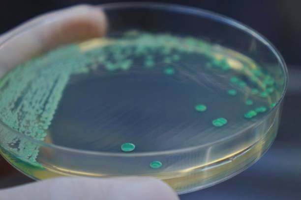 istock Candida albicans yeast growing on a chromogenic medium 1927637995