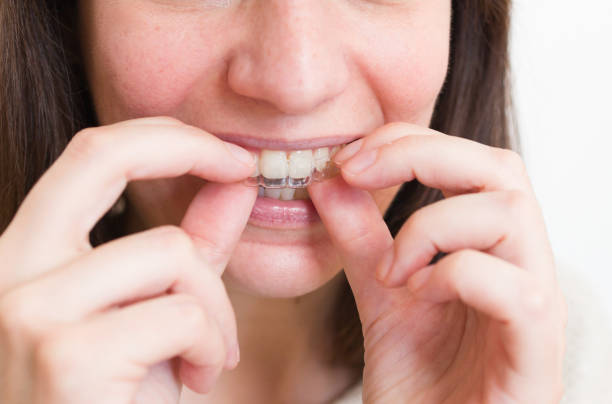 istock invisible orthodontic dental aligner.tooth braces 1928511962