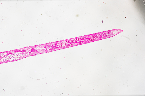 Liver Fluke Section under light microscope with white background