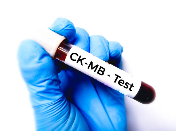 próbka krwi do badania ck-mb. - c._k. zdjęcia i obrazy z banku zdjęć