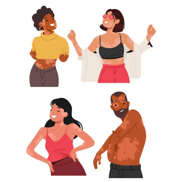 Vector illustration of Joyful People Proudly Embracing Their Unique Beauty, Confidently Displaying Vitiligo Patches. Radiating Self-love