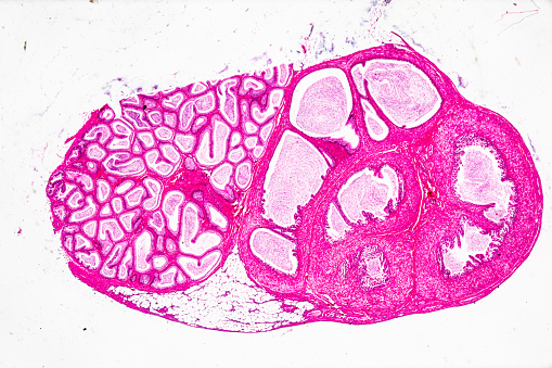 Man head with skull cross section with whole brain. Side view on white background.