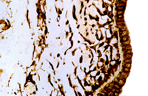 Light micrograph of an unstained iris showing the localization of pigment cells. The melanin pigment is concentrated in the back surface of the iris stroma, near the pigment epithelium (right). Between both, there is a clear band that corresponds to the iris dilator muscle. The anterior surface shows a lower concentration of pigment.