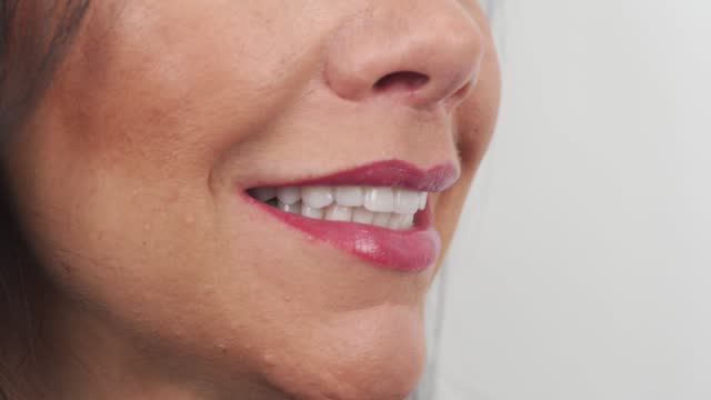 Close-up of woman's smile after installing zirconia veneers, dental ceramic crowns. Female patient smiling after cosmetic dental treatment of teeth by the porcelain veneers. Perfect hollywood smile.