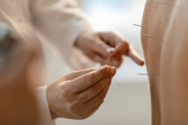 istock Acupuncture back treatment, therapist and patient 1933038903