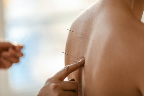 Acupuncture back treatment, therapist and patient