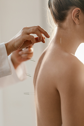 A young woman getting an acupuncture treatment on her back. She is standing in the therapist's office, the therapist is inserting acupuncture needles on her back.