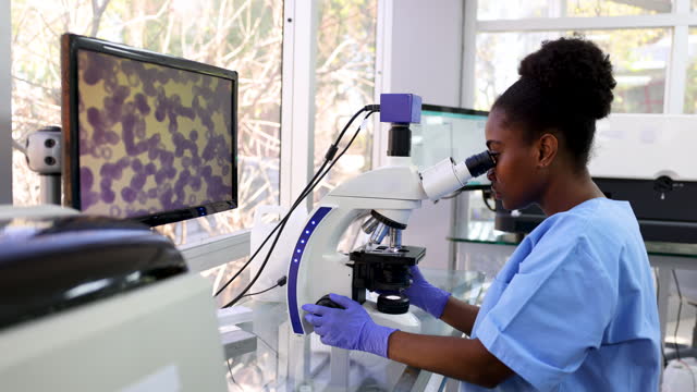 Black female scientist analyzing samples using a microscope at the hospital’s lab