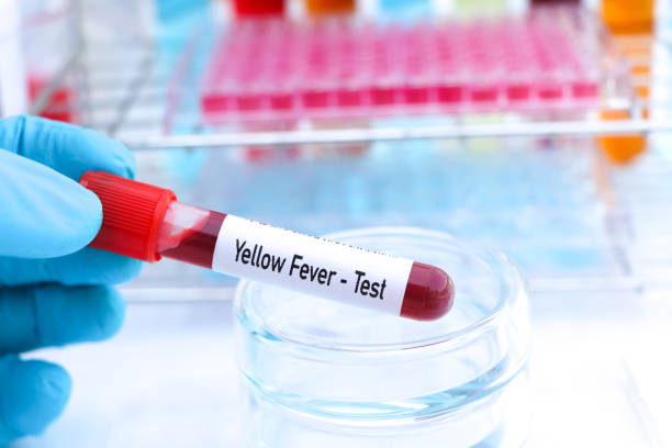 istock Yellow Fever test to look for abnormalities from blood 1935145398