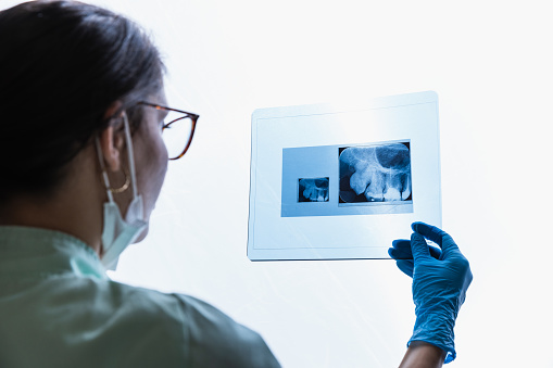Young female dentist examines the patient's panoramic dental X-ray - Stock Photo