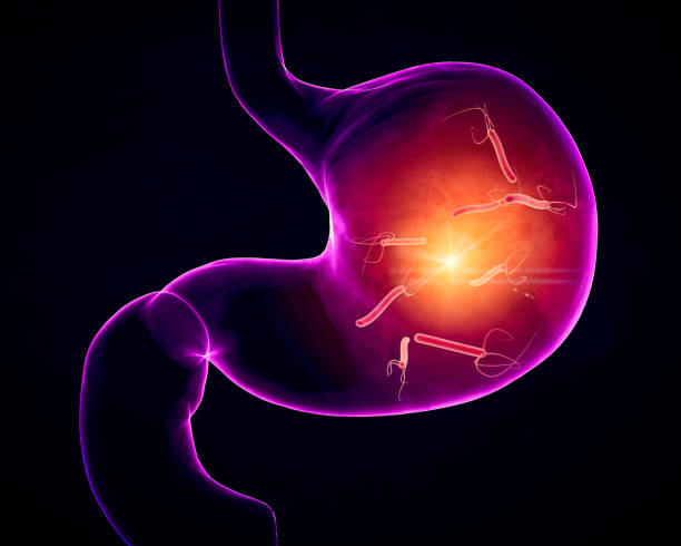 istock Helicobacter pylori is a gram-negative, flagellated, helical bacterium. 1935233354