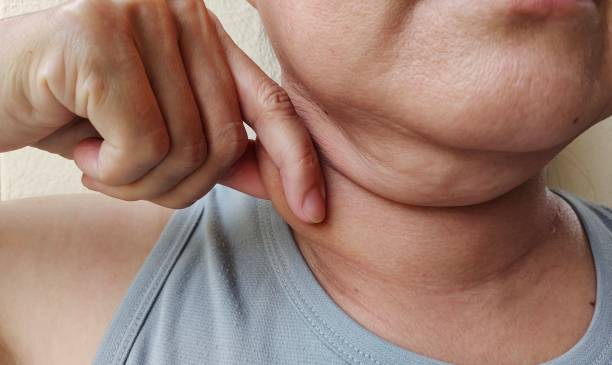 istock The Flabbiness and wrinkle under the neck. 1936605517