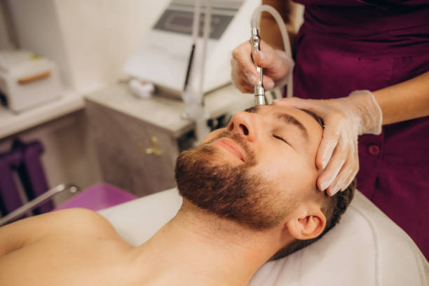 a cosmetologist is making the procedure microdermabrasion of the facial skin in a beauty salon. cosmetology for men and professional skin care. - dermatology dermabrasion surgery medical 뉴스 사진 이미지