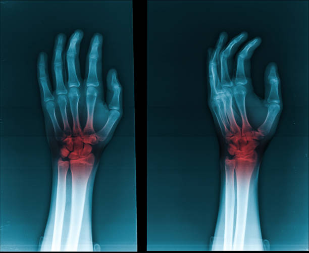 istock X-ray hand and finger, highlighted in red 1937565443