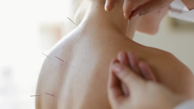 Acupuncture back treatment, therapist and patient