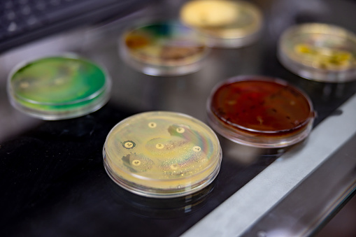 Close-up o fungal cultures in petri dishes at the laboratory - microbiology concepts