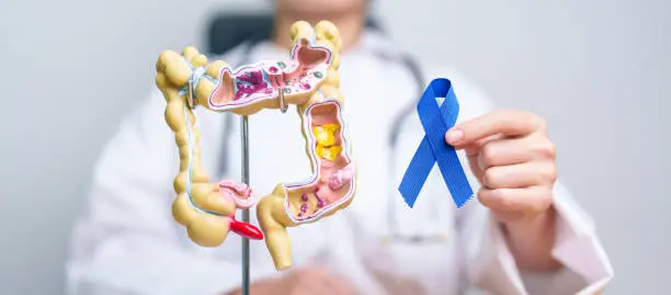 Photo of Doctor holding Blue ribbon with human Colon anatomy model. March Colorectal Cancer Awareness month, Colonic disease, Large Intestine, Ulcerative colitis, Digestive system and Health concept