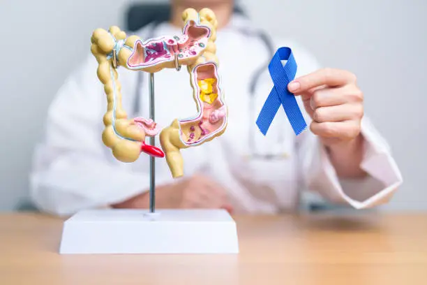 Photo of Doctor holding Blue ribbon with human Colon anatomy model. March Colorectal Cancer Awareness month, Colonic disease, Large Intestine, Ulcerative colitis, Digestive system and Health concept