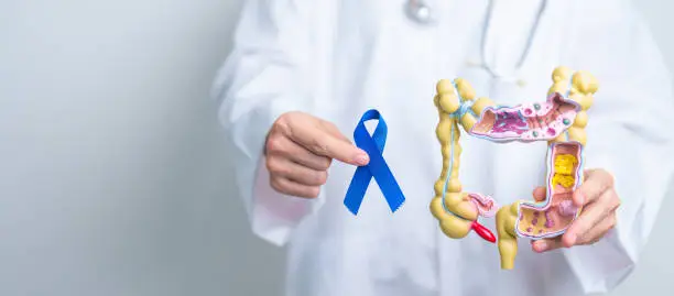 Photo of Doctor holding Blue ribbon with human Colon anatomy model. March Colorectal Cancer Awareness month, Colonic disease, Large Intestine, Ulcerative colitis, Digestive system and Health concept