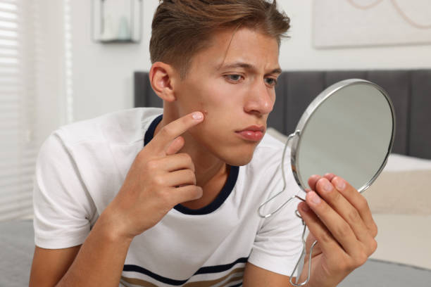 istock Upset young man looking at mirror and touching pimple on his face indoors. Acne problem 1940790512
