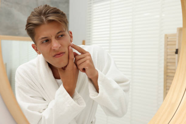 istock Upset young man looking at mirror and popping pimple on his face indoors. Acne problem 1940790530