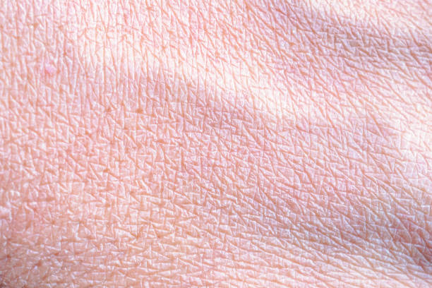 istock dry and dehydrated human skin texture background 1941130728