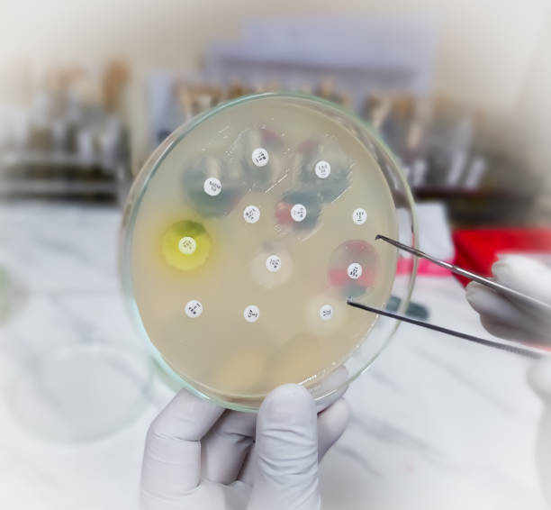 istock Microbiologist check drug inhibition zone, antibiotic resistance or sensitivity test. Antibiotic resistance of bacteria. 1942359142