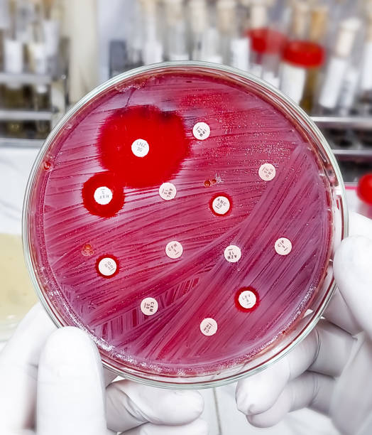 istock Antimicrobial susceptibility testing in petri dish. Antibiotic resistance of bacteria 1942359666