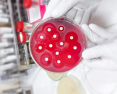 Antimicrobial susceptibility testing in petri dish. Antibiotic resistance of bacteria