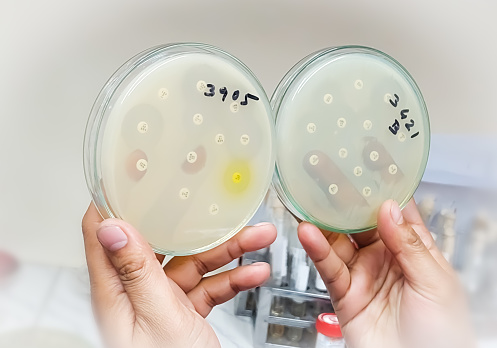 Microbiologist hands holding petri dish for Antimicrobial susceptibility testing. Antibiotic resistance of bacteria