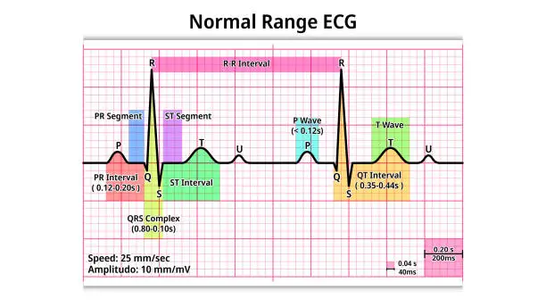 Ecg Complex Identification Free ecg monitor Vector Images & Graphics | FreeImages