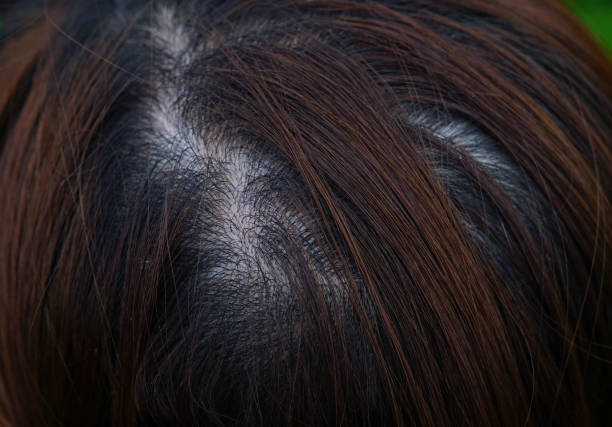 Clean womans scalp with thin dyed hair layers