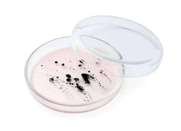 istock Petri dish with bacteria on white background 1943146738