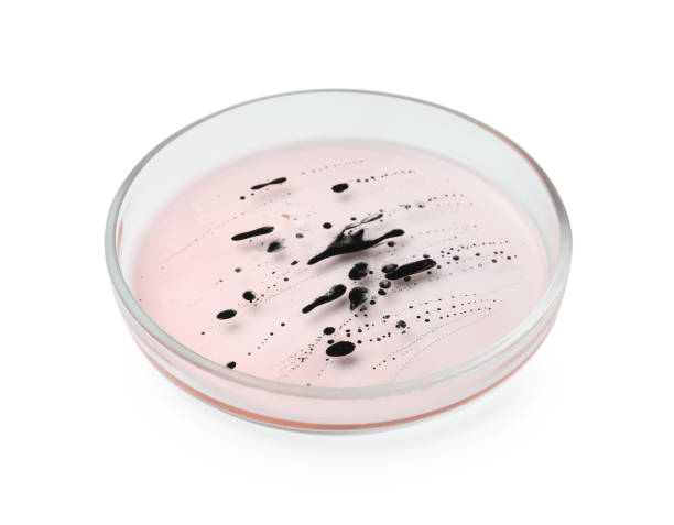 istock Petri dish with bacteria on white background 1943146748