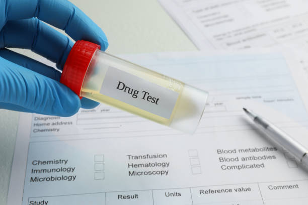 istock Drug test. Laboratory worker holding container with urine sample over medical form on table, closeup 1943219385