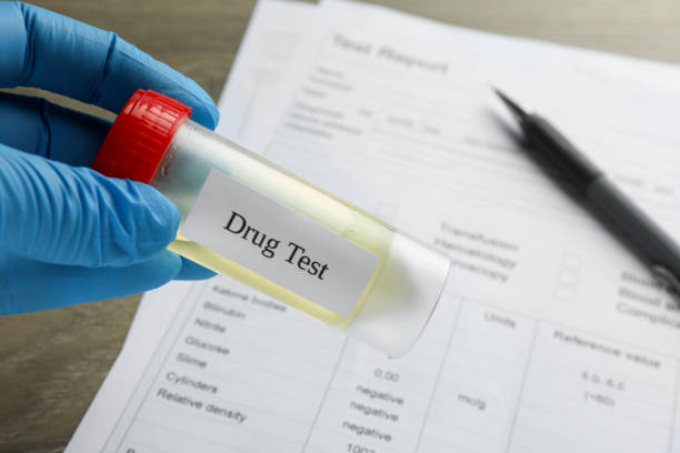 istock Drug test. Laboratory worker holding container with urine sample at table, closeup 1943220436
