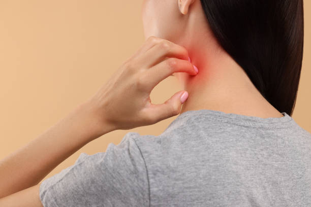 istock Suffering from allergy. Young woman scratching her neck on beige background, back view 1943302918
