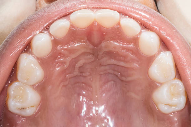Close up picture of young woman's oral cavity at the dentist office