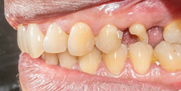 istock Lateral view close-up dentistry case macrophotography 1943336228