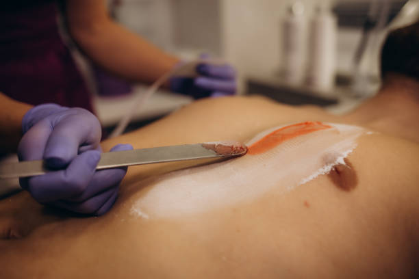 primo piano del petto peloso di un uomo che usa l'epilazione con cera a casa. scaldacera per la depilazione del corpo. foto di alta qualità. foto di alta qualità - hairy men shaving chest foto e immagini stock