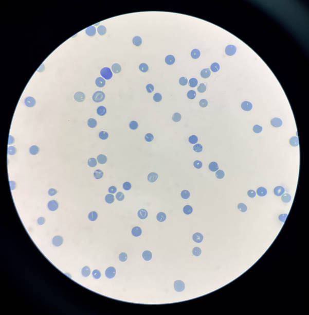 istock Reticulocytes is red blood cell immature. 1944647697