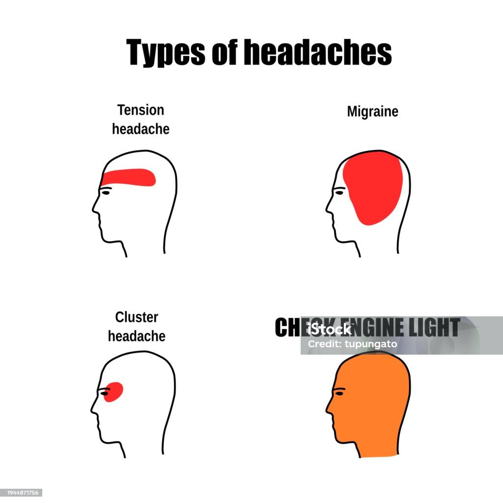 Check Engine Brain Picture Meme About Check Engine Light Stock Illustration - Download Image Now ...