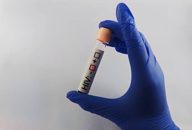 istock Diagnostician holding in hand a negative HIV test. 1945136710