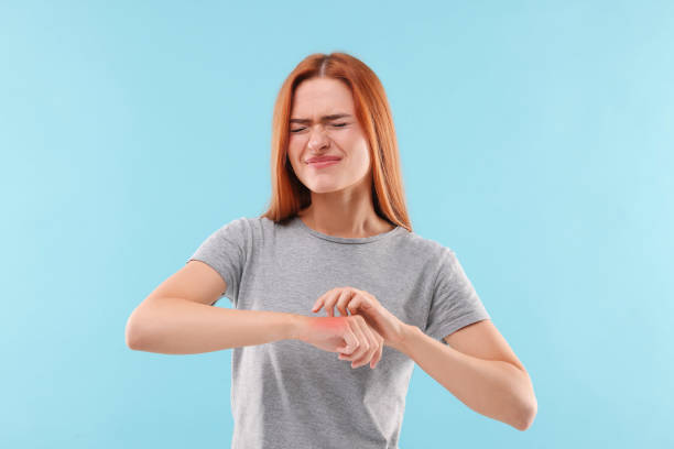istock Suffering from allergy. Young woman scratching her arm on light blue background 1945841448