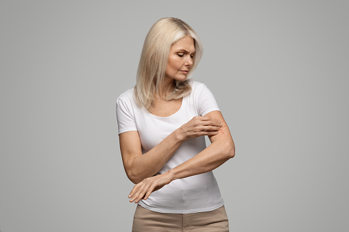 Dermatitis, eczema, allergy, psoriasis concept. Annoyed mature woman in white t-shirt scratching irritated skin on arm, senior female having itching rash on body, standing on grey studio background
