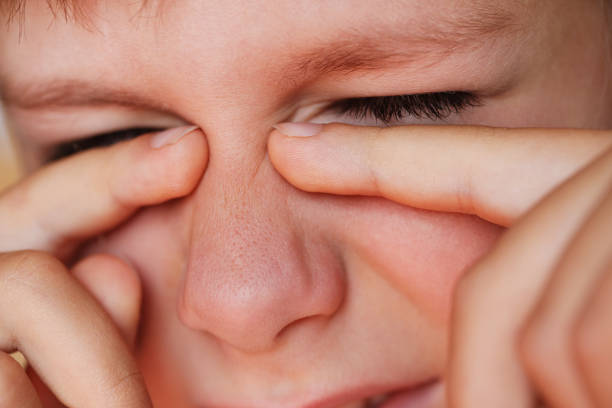 Allergic boy scratching his eyes close-up view Allergic boy scratching his eyes close-up view human eye scratching allergy rubbing stock pictures, royalty-free photos & images